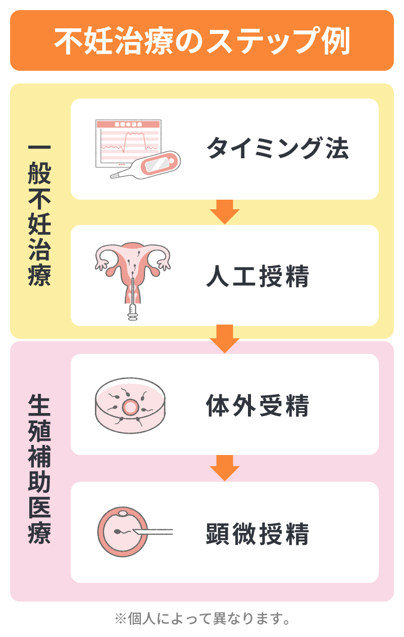 不妊治療のステップ例
